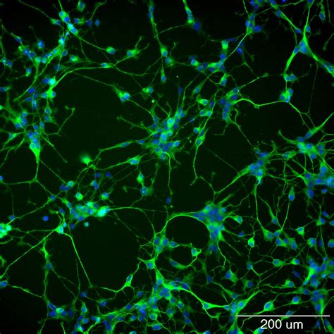 Involvement of extracellular matrix in brain plasticity and memory ...