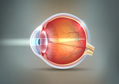 Corneal Cross Linking Strengthens The Cornea Drholzman