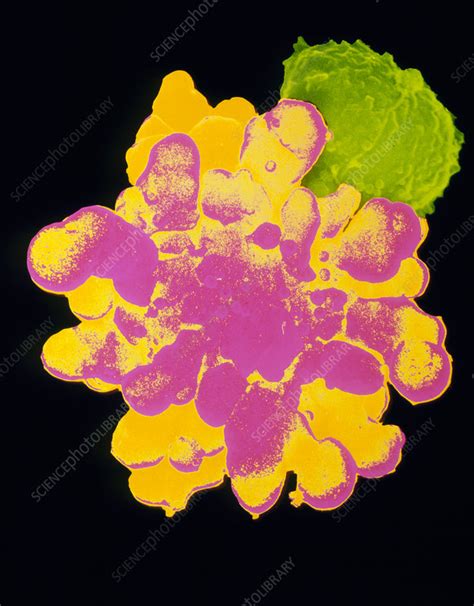 False Col Sem Of T Lymphocyte Killer Cell Stock Image M