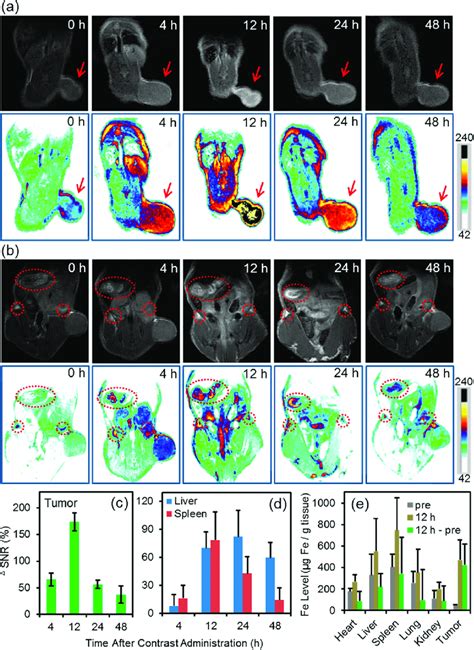 T 1 Weighted MR Images Of U 87 MG Tumor Bearing Nude Mice Slice