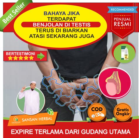 Obat Benjolan Testis Bengkak Dan Nyeri Obat Benjolan Testis Bengkak