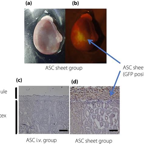 Adiposederived Mesenchymal Stem Cell Asc Sheets Directly