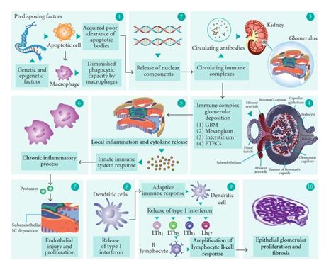 Lupus Nephritis Signs And Symptoms