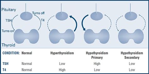 Triiodothyronine (T3) – when to test your hormone levels. T3 and ...