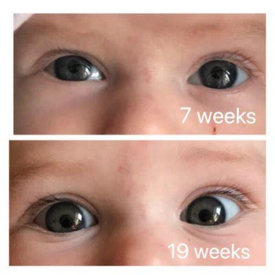 Eyes still grey at 5 months? | BabyCenter