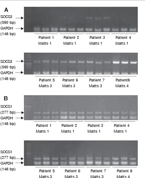 Table From Clinical Significance Of Mucosal Suppressors Of Cytokine