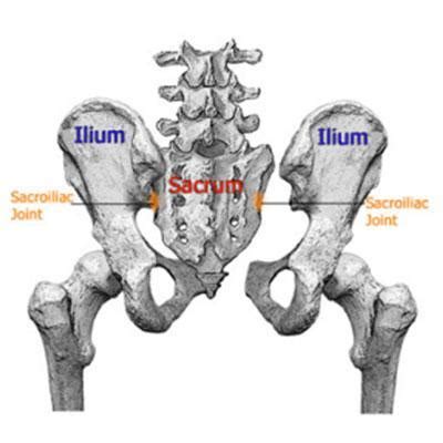 Sacroiliac Joint Injection Sarasota FL Pain Medicine Group