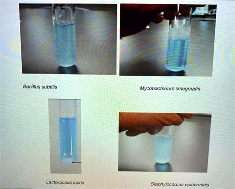 SOLVED Bacillus Subtilis Mycobacterium Smegmatis Lactococcus Iactis