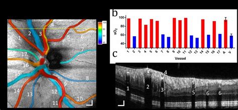 Oximetry Map Of The Optic Disk A So 2 Measurements In 17 Vessels In