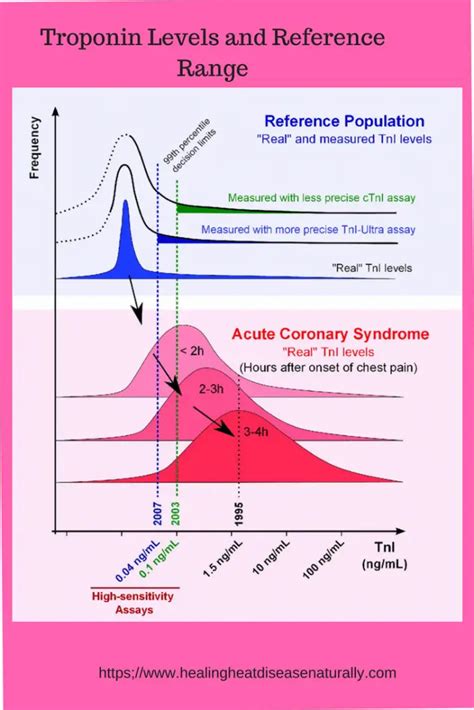 What is Normal Troponin Level : Reference Range and Interpretation