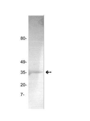 Coagulation Factor II Thrombin Products Bio Techne