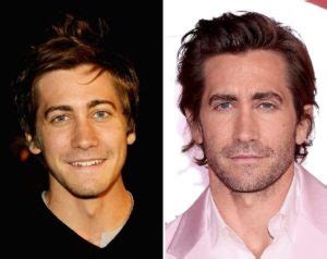 Jake Gyllenhaal Before And After Plastic Surgery Nose