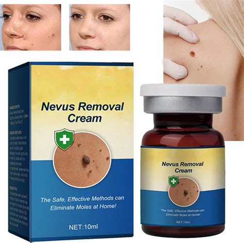 Koahde Warts Removal Creams Skin Tag Removal Creams Removing Moles