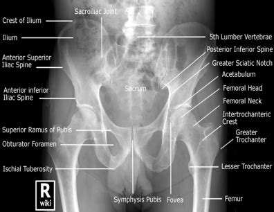 RAD Positioning Chapter 7 Femur Pelvic Girdle Flashcards Quizlet