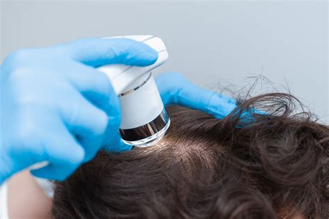 Trichoscopy Advances Hair And Scalp Disease Diagnoses