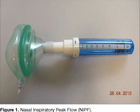 Figure 1 From Peak Nasal Inspiratory Flow Evaluation As An Objective