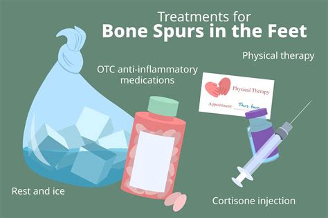 Causes And Treatment Of Bone Spurs In Feet 2023