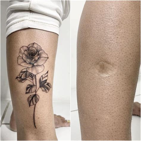 Tatuagem Para Cobrir Cicatriz A Solu O