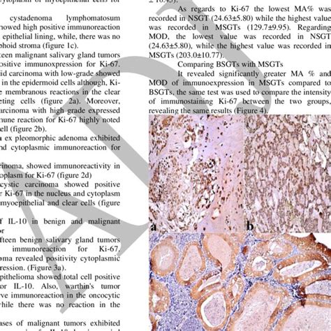 A Pleomorphic Adenoma Showing Intense Immunopositivity To Ki67 In Download Scientific Diagram