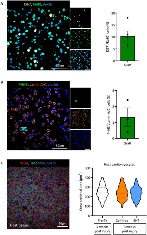 Analysis Of Graft Proliferation And Cell Size In The Remote Myocardium