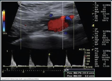 Abdominal Doppler Splanchnic Circulation Flashcards Quizlet