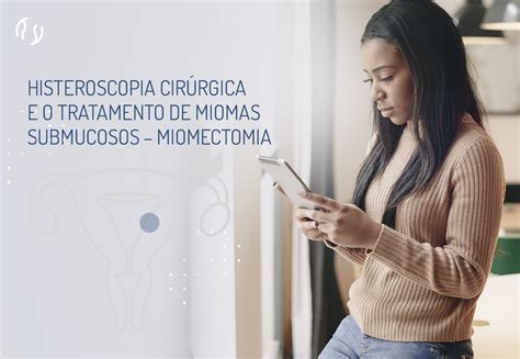 Histeroscopia Cir Rgica E O Tratamento De Miomas Miomectomia Dr