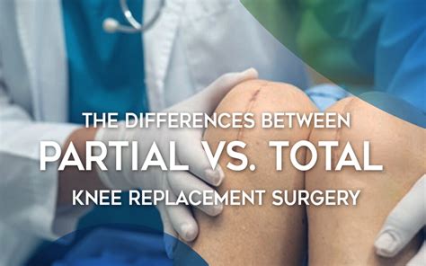 The Differences Between Partial Vs Total Knee Replacement Io Core