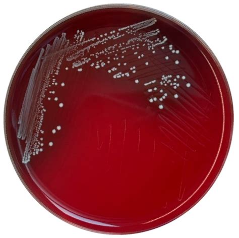 Genomic Characterization And Safety Evaluation Of Enterococcus Lactis