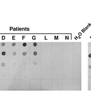 Dot-blot hybridization of specific reverse transcription-polymerase ...