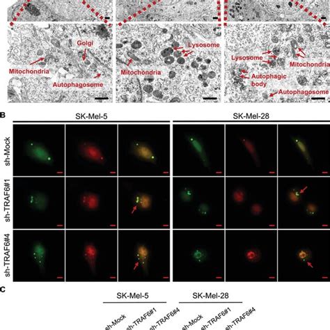 Knocking Down Of Traf6 Induces Autophagy In Melanoma Cells A