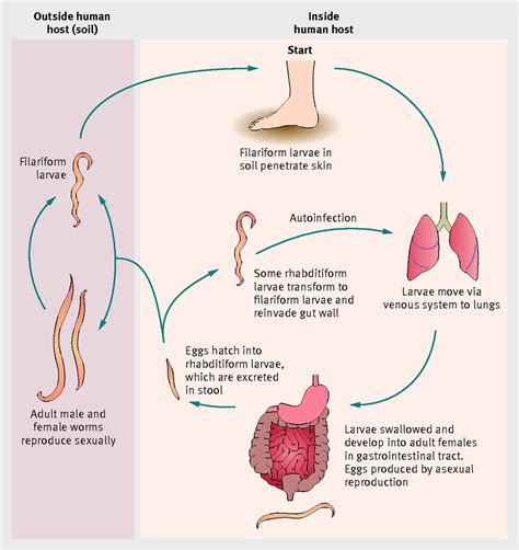 Strongyloides Stercoralis Infection The Bmj