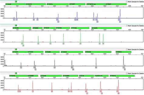 Developmental Validation Of A Novel 5 Dye Y STR System Comprising The