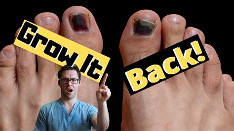 Toenail Falling Off How To Make It Grow Back Top 4 Causes Youtube