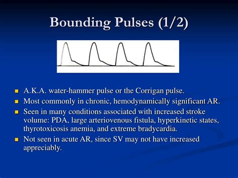 PPT - Pulse PowerPoint Presentation - ID:485278