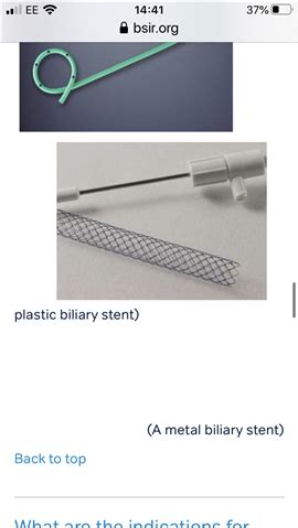 Stent in the Liver - Macmillan Online Community