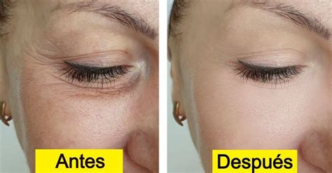 Crema Casera Con Tres Ingredientes Para Rejuvenecer El Contorno De Ojos Contorno De Ojos