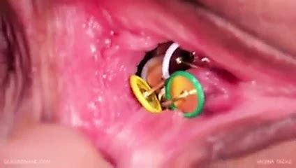 Queensnake Staple Duel 2 Free BDSM Porn B3 XHamster