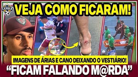 Imagens De Cano E Rias Lesionados Infos Atualizadas Absurdo Lima