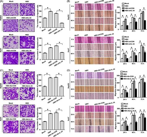 The Effect Of Il‐34 In The Migration Of Hcc Cells Mediated By Hbx A