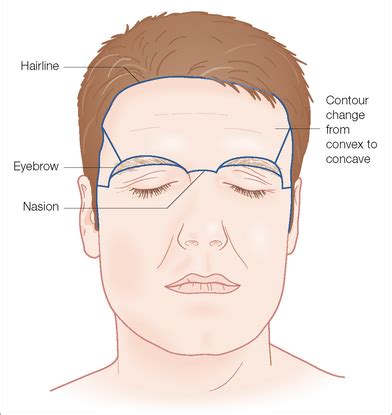 Forehead and Temple | Clinical Gate