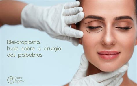 Blefaroplastia tudo sobre a cirurgia das pálpebras Dr Pedro Fragoso