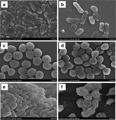 Sem Micrographs Of Culturable Cells And Vbnc State Cells Of E Coli