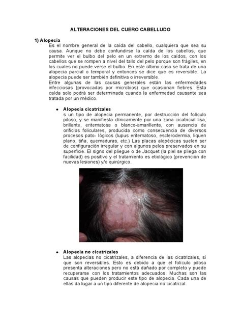 Alteraciones Del Cuero Cabelludo Pdf Perdida De Cabello Pelo