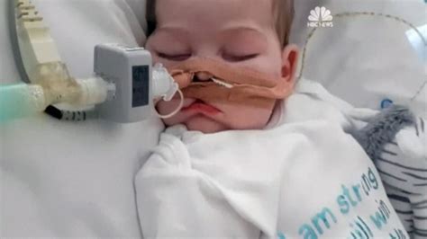 Charlie Gard Case Baby Boy At Center Of Ethics Debate