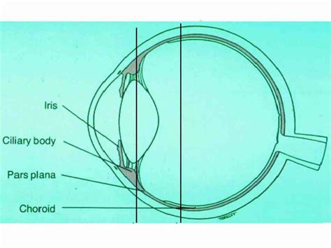 Uveitis En Ojopedia