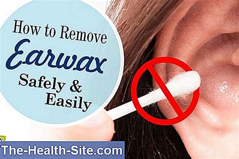 Remove Earwax This Is How It Works Correctly And Safely 💊 Scientific