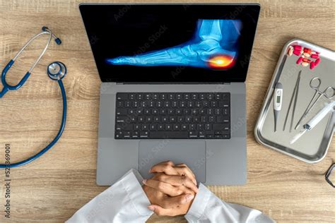 Top view of doctor showing a x-ray of foot. Pain heel and foot injury Stock Photo | Adobe Stock