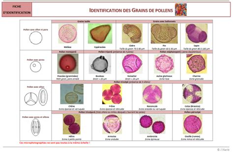 Retrouver Et Extraire Des Restes De V G Tation Les Pollens