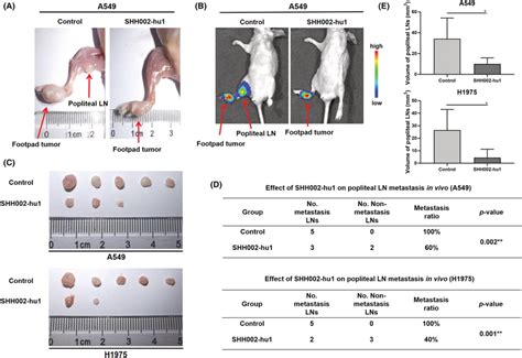 Shh002‐hu1 Suppresses Ln Metastasis Of Nsclc In Vivo A Download Scientific Diagram