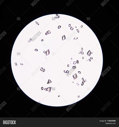 Uric Acid In Urine Sediment Stock Photo And Stock Images Bigstock